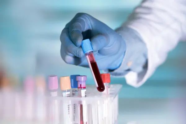 Blood test sample collection at home in Dubai