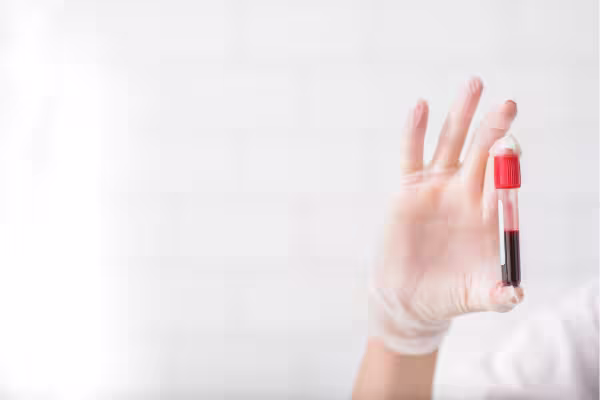 complete body checkup Dubai DHA-licensed nurse home blood sample collection