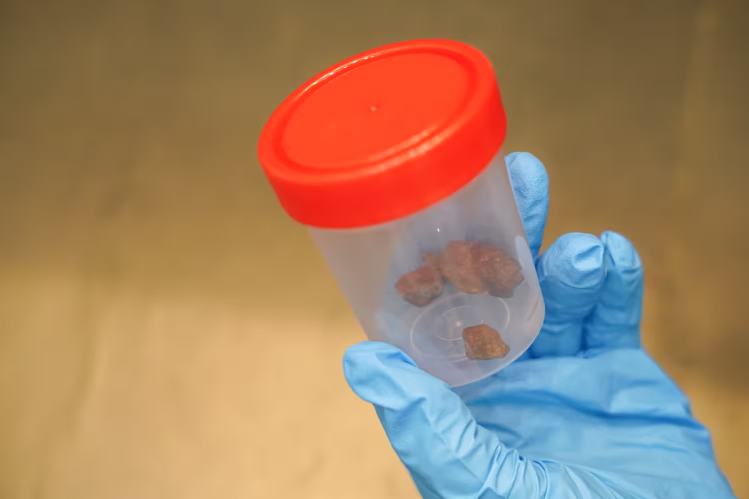 stool test at home Dubai - DrPlus DHA-licensed nurse providing sample collection kit at home